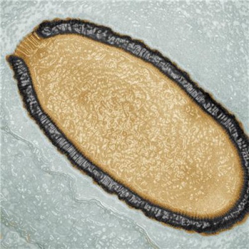 30,000 year-old giant virus found in Siberia