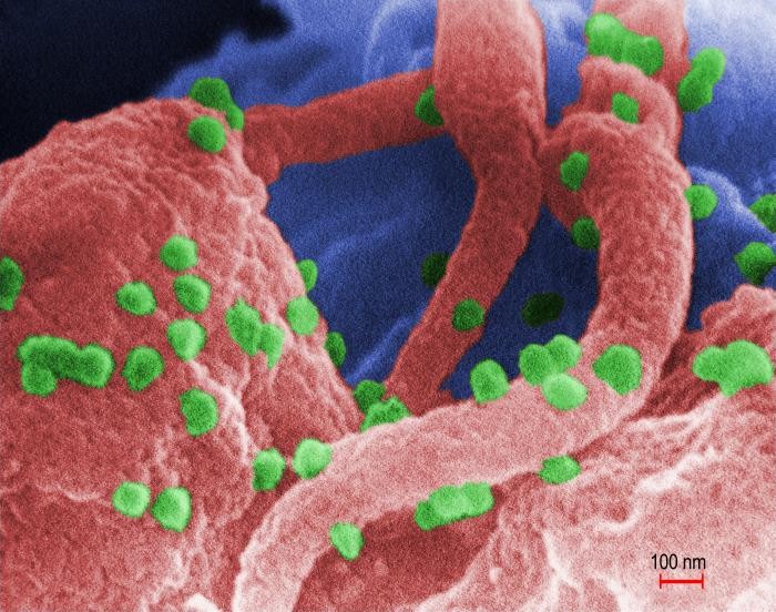 Researchers eliminate HIV from cultured human cells for first time