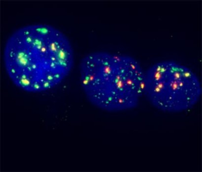 Key to aging immune system: Discovery of DNA replication problem