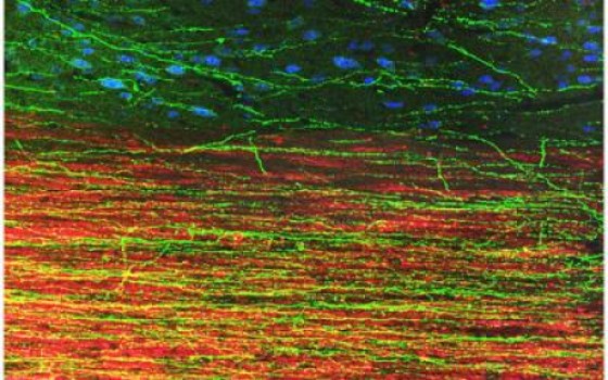 Dramatic growth of grafted stem cells in rat spinal cord