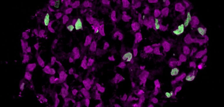 Egg and sperm race: Scientists create precursors to human egg and sperm
