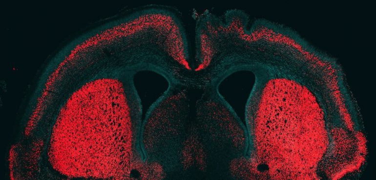 ‘Big Brain’ Gene Found in Humans, Not Chimps
