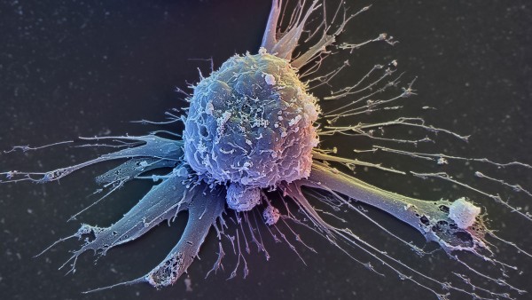 Relaxed DNA may contribute to aging