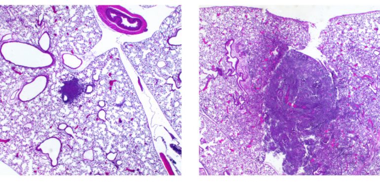 How small genetic change in Yersinia pestis changed human history