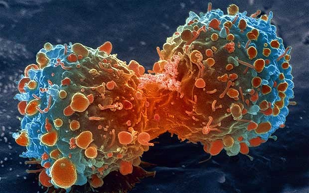 Researchers hail new cancer treatment: Unlocking the body’s immune system