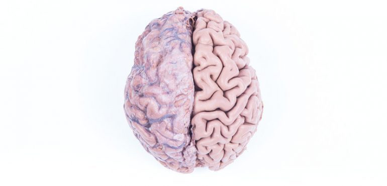 Stem cell research hints at evolution of human brain