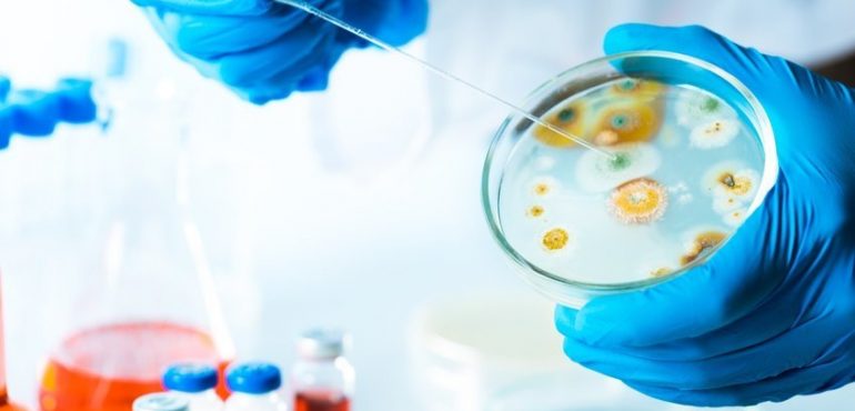 Novel theoretical approach to reduce antibiotic resistance