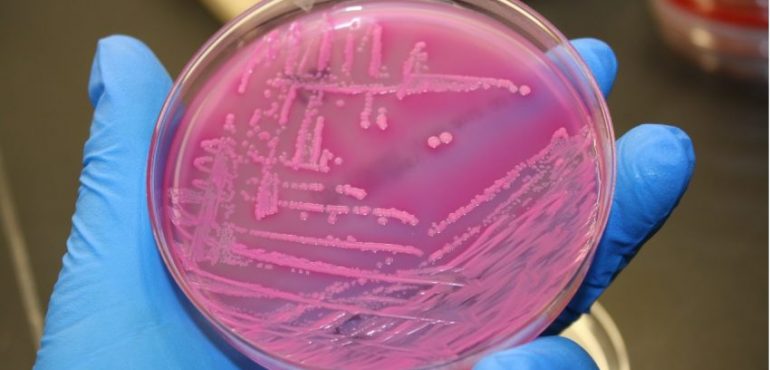 Not unexpectedly, a new drug-resistant ‘superbug’ pops up in the United States