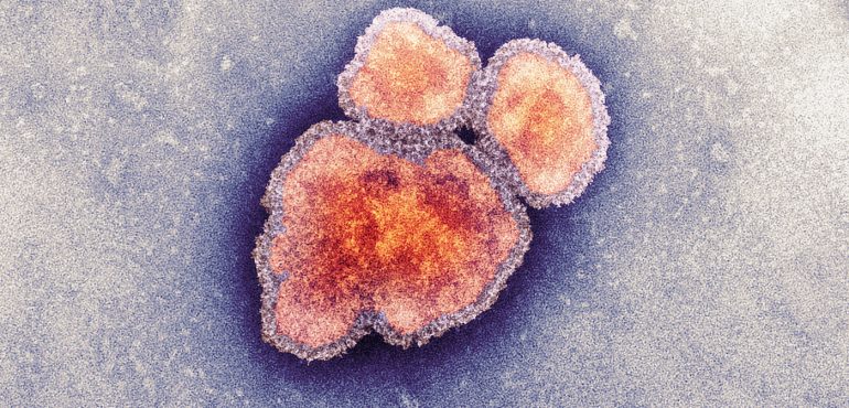 Measles Has Officially Been Eliminated In The Americas
