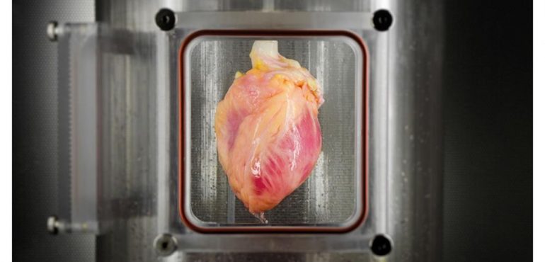 Scientists Grow Full-Sized, Beating Human Heart from Stem Cells