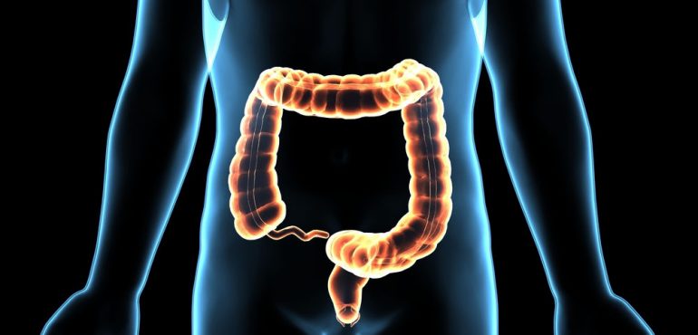 Colorectal Cancer Rates Rise Sharply in Younger US Adults