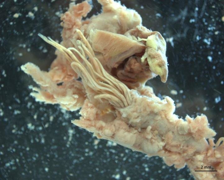 Potentially lethal parasite rat lungworm found throughout Florida