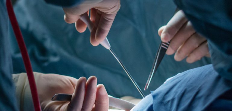 A new microscope uses light to ‘cut’ through tissue samples and find cancer