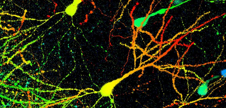 Researchers Discover ‘Anxiety Cells’ In The Brain