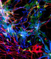 Trio of genes supercharged human brain evolution