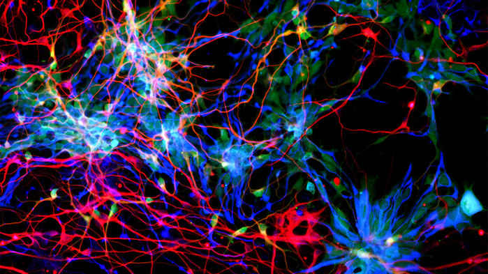 Trio of genes supercharged human brain evolution