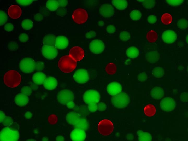 Artificial cells are tiny bacteria fighters