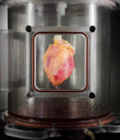 Scientists Grow Full-Sized, Beating Human Hearts From Stem Cells