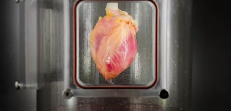 Scientists Grow Full-Sized, Beating Human Hearts From Stem Cells