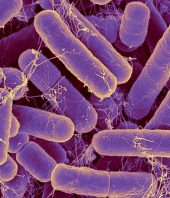 The bacteria in your gut may reveal your true age