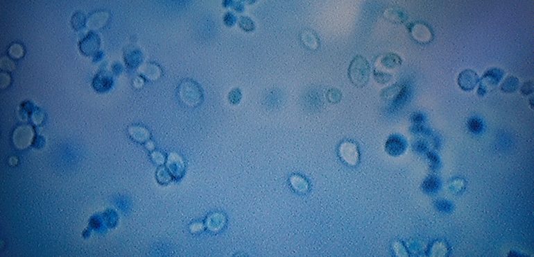 A Mysterious Infection, Spanning the Globe in a Climate of Secrecy