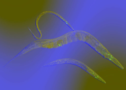 In a first, scientists pinpoint neural activity’s role in human longevity