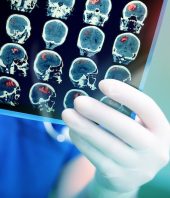 Scientists find ally in fight against brain tumors: Ebola