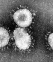 Here’s how long coronaviruses may linger on contaminated surfaces, according to science