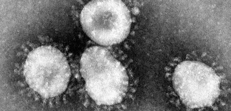 Here’s how long coronaviruses may linger on contaminated surfaces, according to science