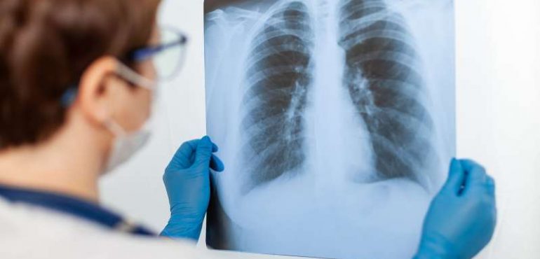 Steroid dexamethasone reduces deaths among patients with severe COVID-19 – trial shows