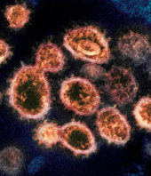 Scientists pinpoint genes common among people with severe coronavirus infections