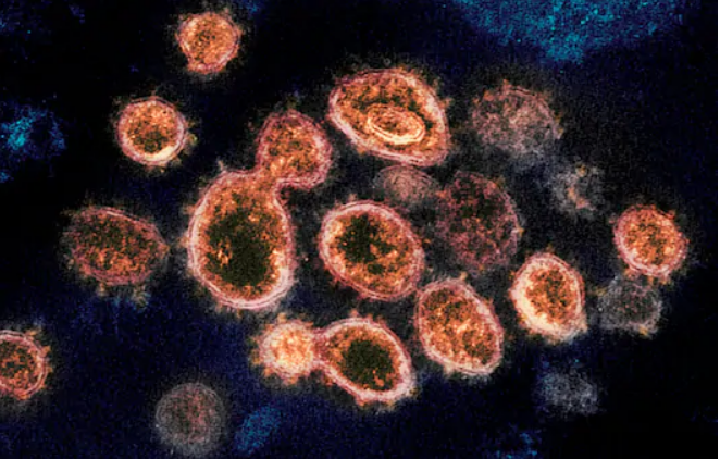 Scientists pinpoint genes common among people with severe coronavirus infections